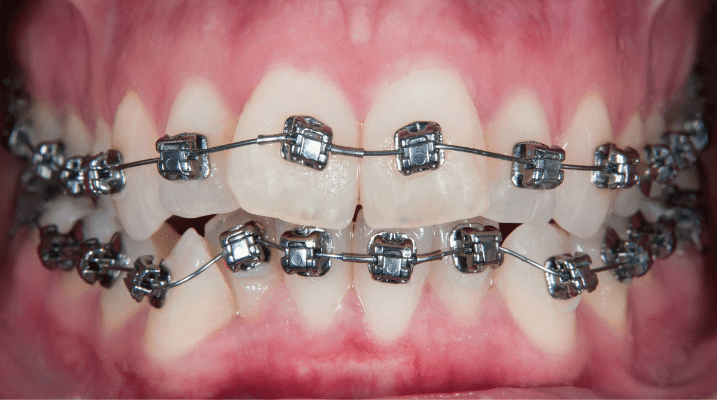 Professional Dental & Orthodontics - Copia de Copia de Sin titulo 2