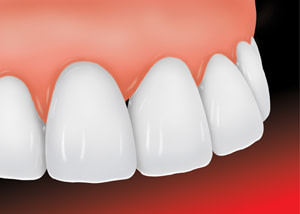 Professional Dental & Orthodontics - ADA Dental Veneer 2 new